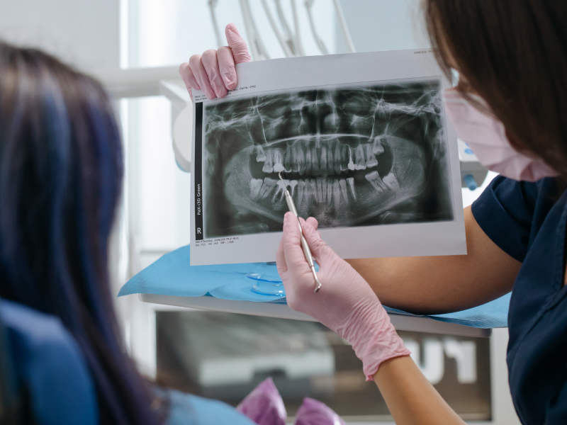 Dental-X-Ray